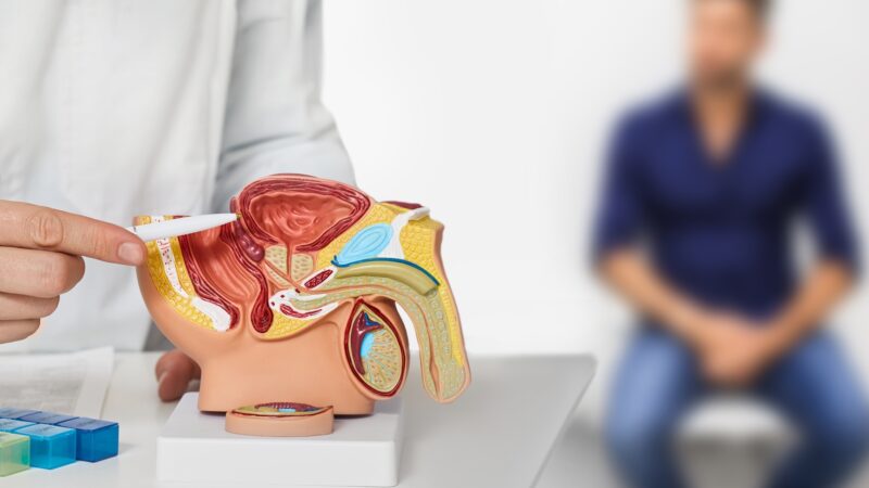 Q. Roo encabeza incidencia de cáncer de próstata en la Península